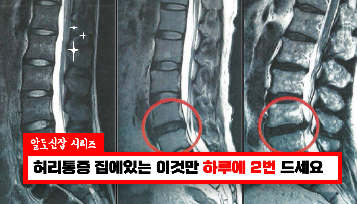 허리요통이 있으시다면 이방법은 100% 허리통증을 사라지게 해줍니다